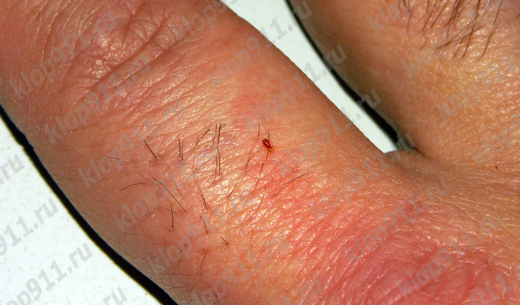 Larven drikker blod